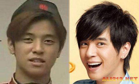 中国娱乐圈面瘫问题,探究中国明星面无表情的背后原因